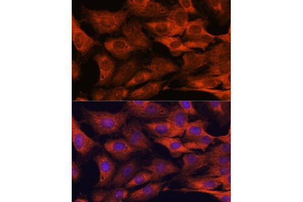 MALT1 antibody  (AA 125-450)