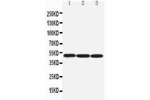 Image no. 1 for anti-Arrestin, beta 1 (ARRB1) (AA 82-103), (N-Term) antibody (ABIN3043990)
