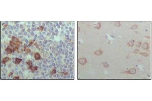 Image no. 1 for anti-EPH Receptor B6 (EPHB6) antibody (ABIN1107117)