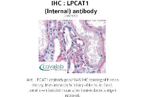 Image no. 1 for anti-Lysophosphatidylcholine Acyltransferase 1 (LPCAT1) (Internal Region) antibody (ABIN1736534)
