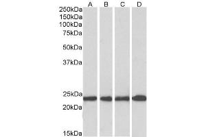 Image no. 4 for anti-Superoxide Dismutase 2, Mitochondrial (SOD2) (AA 119-130) antibody (ABIN768566)