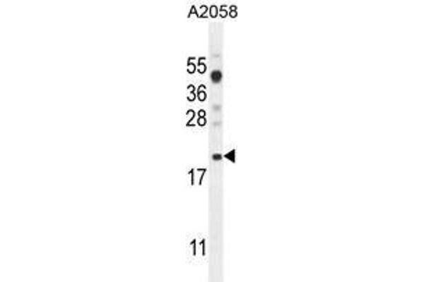 anti-Variable Charge, X-Linked (VCX) (AA 1-30), (N-Term) antibody