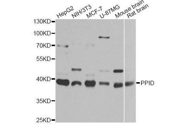 PPID 抗体  (AA 161-370)