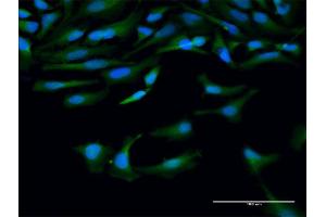 Immunofluorescence of purified MaxPab antibody to CAPN10 on HeLa cell.