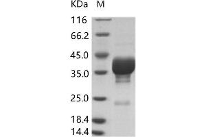 Image no. 1 for Coxsackie Virus A16 VP4 (Cox A16 VP4) protein (Fc Tag) (ABIN7198888)