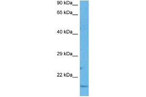 MT-ND6 antibody  (Middle Region)