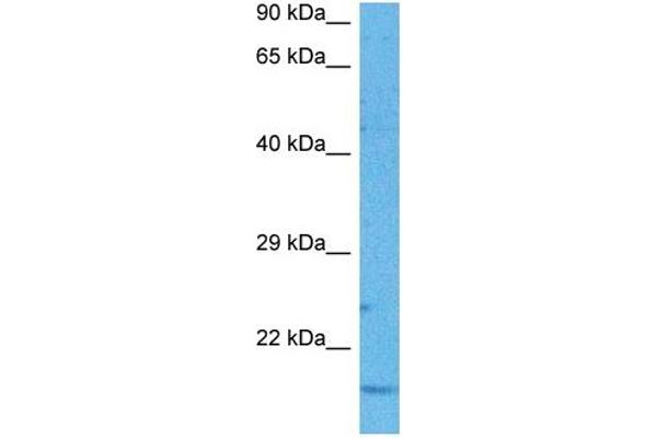 MT-ND6 antibody  (Middle Region)