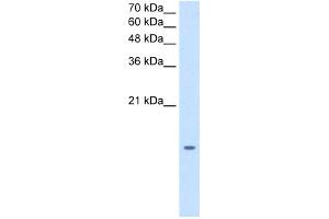 Image no. 3 for anti-Microsomal Glutathione S-Transferase 2 (MGST2) (N-Term) antibody (ABIN2773859)