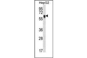 Image no. 2 for anti-Cytochrome P450, Family 2, Subfamily S, Polypeptide 1 (CYP2S1) (AA 406-436), (C-Term) antibody (ABIN951784)