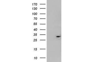 Image no. 1 for anti-Mitochondrial Translational Initiation Factor 3 (MTIF3) (AA 56-278) antibody (ABIN1491594)