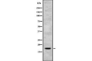 Image no. 1 for anti-Prolactin-Induced Protein (PIP) (Internal Region) antibody (ABIN6264228)