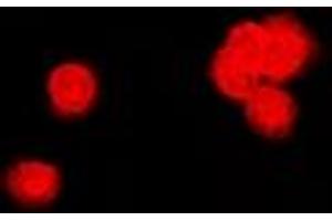 Image no. 2 for anti-Protein Phosphatase 2A Activator, Regulatory Subunit 4 (PPP2R4) (full length) antibody (ABIN6005972)