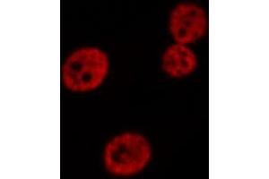 Image no. 3 for anti-Mitogen-Activated Protein Kinase 9 (MAPK9) (C-Term) antibody (ABIN6254890)