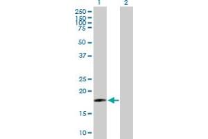 Western Blot analysis of SIVA1 expression in transfected 293T cell line by SIVA1 MaxPab polyclonal antibody.