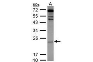 Image no. 2 for anti-Cytoglobin (CYGB) (AA 1-190) antibody (ABIN1501883)