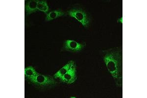 Image no. 6 for anti-Myosin Phosphatase, Target Subunit 1 (PPP1R12A) (AA 1-40), (N-Term) antibody (ABIN3043902)