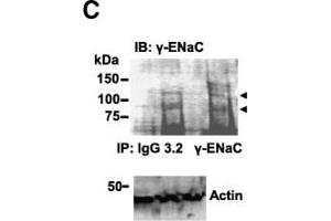 Image no. 5 for anti-Sodium Channel, Nonvoltage-Gated 1 alpha (SCNN1A) (AA 629-650) antibody (ABIN863204)