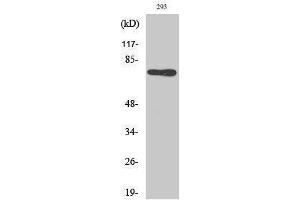 Image no. 1 for anti-Midline 1 (MID1) (N-Term) antibody (ABIN3185563)