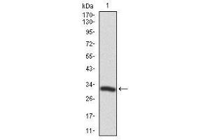 Image no. 4 for anti-Twinfilin, Actin-Binding Protein 1 (TWF1) antibody (ABIN1491429)