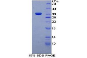 Image no. 1 for Nucleoporin 88kDa (NUP88) (AA 159-422) protein (His tag) (ABIN1879635)