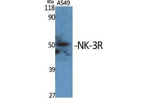 Image no. 2 for anti-Tachykinin Receptor 3 (TACR3) (C-Term) antibody (ABIN3185912)