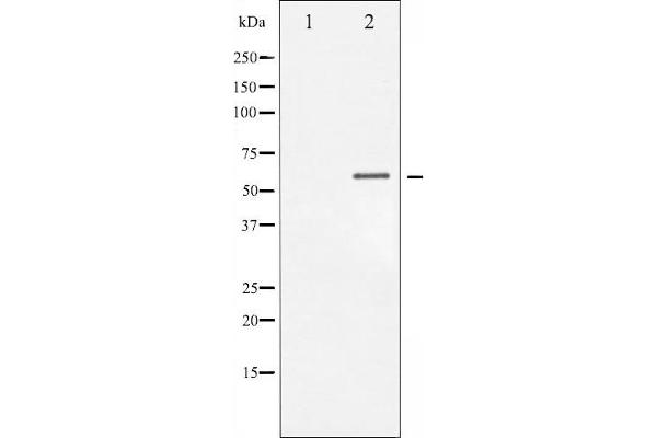 CHEK1 anticorps  (pSer317)