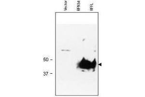 Western blot using  Protein A Purified anti-RFFL antibody shows detection of RFFL (arrowhead) in lysate.