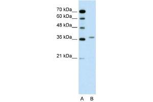 Image no. 2 for anti-Aminolevulinate Dehydratase (ALAD) (N-Term) antibody (ABIN2776921)