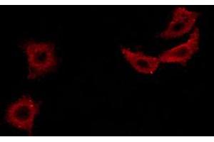 Image no. 4 for anti-Insulin Receptor Substrate 1 (IRS1) (pSer307) antibody (ABIN6255185)