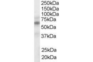 Image no. 2 for anti-Nuclear Receptor Subfamily 1, Group H, Member 2/3 (NR1H2/3) (Internal Region) antibody (ABIN185294)
