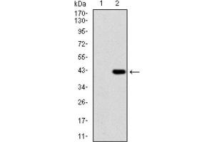 Image no. 5 for anti-Niemann-Pick Disease, Type C1 (NPC1) (AA 34-174) antibody (ABIN1845969)