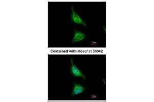 ICC/IF Image Immunofluorescence analysis of methanol-fixed HeLa, using Aladin, antibody at 1:500 dilution.