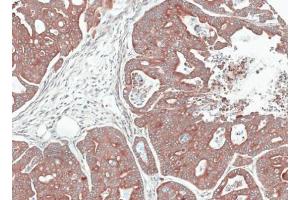 Image no. 2 for anti-Nephroblastoma Overexpressed (NOV) (Center) antibody (ABIN2855618)