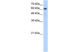 Image no. 1 for anti-ADAM Metallopeptidase Domain 30 (ADAM30) (N-Term) antibody (ABIN630427)