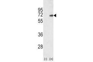 Image no. 2 for anti-SMAD Family Member 4 (SMAD4) (AA 400-428) antibody (ABIN3032608)