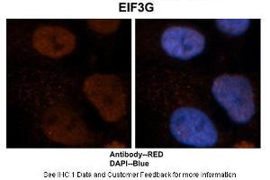 Image no. 5 for anti-Eukaryotic Translation Initiation Factor 3, Subunit G (EIF3G) (Middle Region) antibody (ABIN2778865)