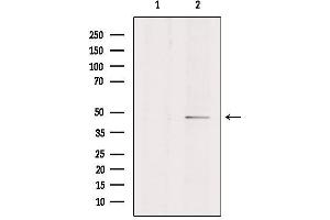 Image no. 2 for anti-Endothelin Receptor Type A (EDNRA) antibody (ABIN6257158)