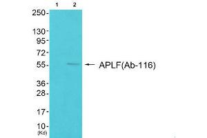 Image no. 5 for anti-Aprataxin and PNKP Like Factor (APLF) (Ser116) antibody (ABIN1848316)
