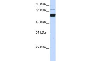 WB Suggested Anti-ZNF93 Antibody Titration:  0.