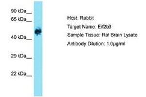 Image no. 1 for anti-Eukaryotic Translation Initiation Factor 2B, Subunit 3 Gamma, 58kDa (EIF2B3) (AA 121-170) antibody (ABIN6750525)