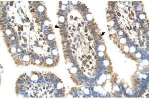 Image no. 2 for anti-Complement Component 8, beta Polypeptide (C8B) (Middle Region) antibody (ABIN2781763)