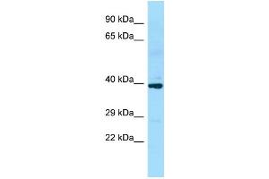 Image no. 1 for anti-Solute Carrier Family 35 (UDP-GlcNAc/UDP-Glucose Transporter), Member D2 (SLC35D2) (C-Term) antibody (ABIN2774464)