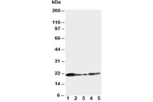 Image no. 1 for anti-Caveolin 1, Caveolae Protein, 22kDa (CAV1) (C-Term) antibody (ABIN3030337)