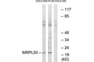 anti-Mitochondrial Ribosomal Protein L50 (MRPL50) (AA 109-158) antibody