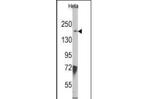 Kdm6b Antikörper  (N-Term)