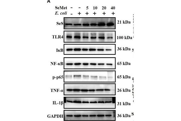 NF-kB p65 antibody  (pSer536)