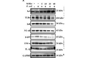Image no. 8 for anti-Nuclear Factor-kB p65 (NFkBP65) (pSer536) antibody (ABIN730528)