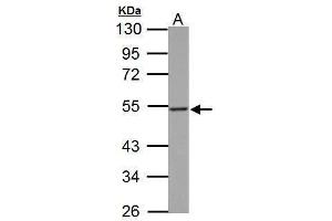 WB Image PD-ECGF antibody detects TYMP protein by Western blot analysis.