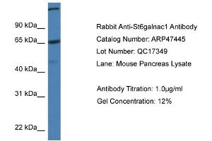 Image no. 1 for anti-ST6 (Alpha-N-Acetyl-Neuraminyl-2,3-beta-Galactosyl-1,3)-N-Acetylgalactosaminide alpha-2,6-Sialyltransferase 1 (ST6GALNAC1) (C-Term) antibody (ABIN2782969)
