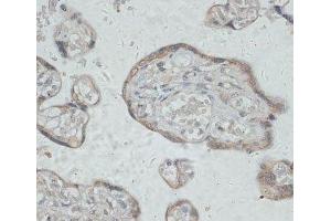 Immunohistochemistry of paraffin-embedded Human placenta using GPR78 Polyclonal Antibody at dilution of 1:100 (40x lens).